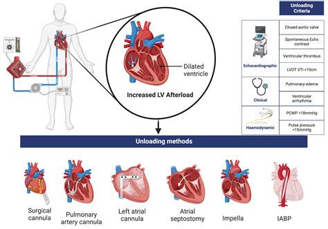 lv unloading ecmo|unloading left ventricle ecmo.